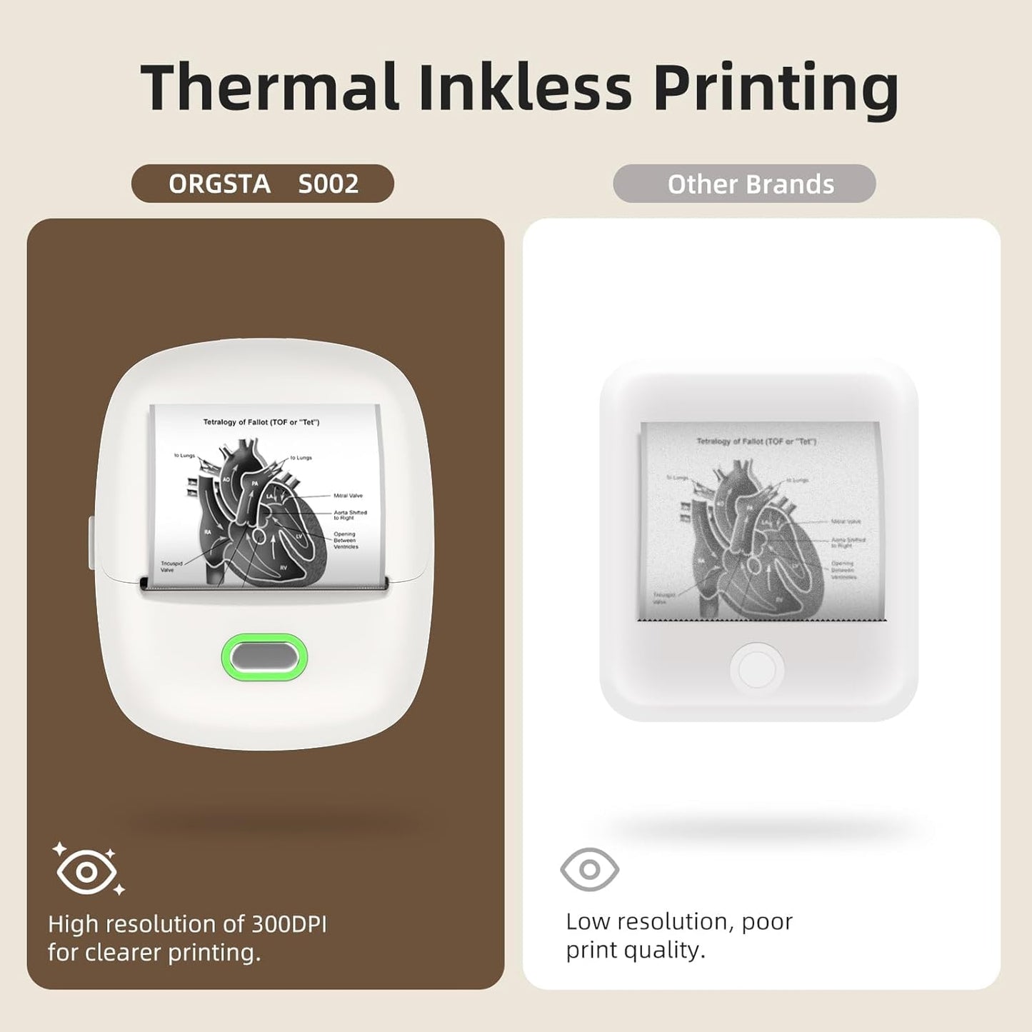 ORGSTA S002 Sticker Printer - Mini Printer Portable Thermal Sticker Maker, Bluetooth Print Pod Inkless Label Maker for Photos, Journal, Receipts, DIY Creation